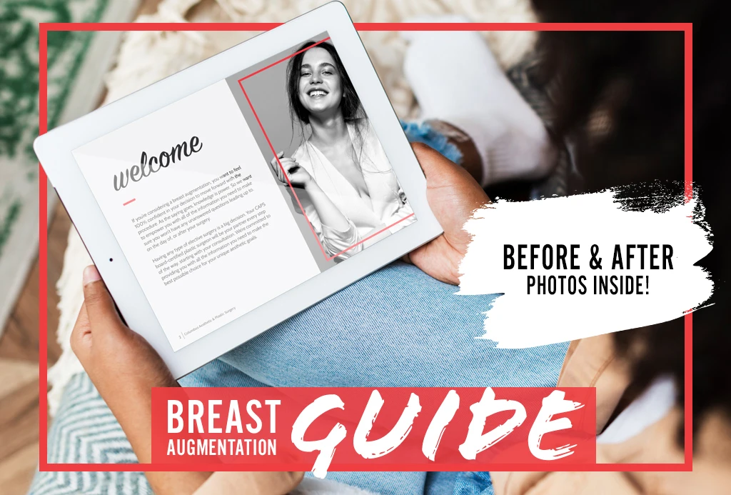 Breast Augmentation Guide tout